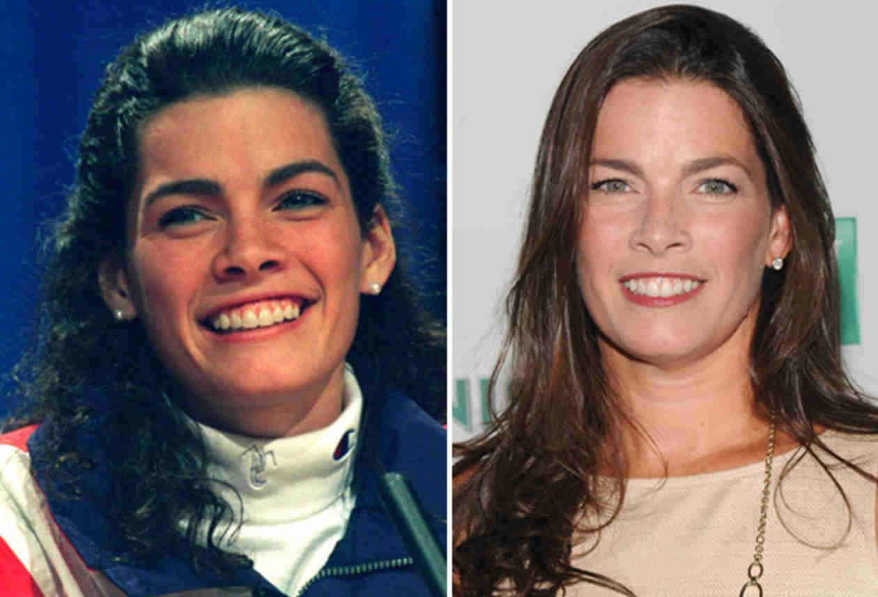 Nancy Kerrigan