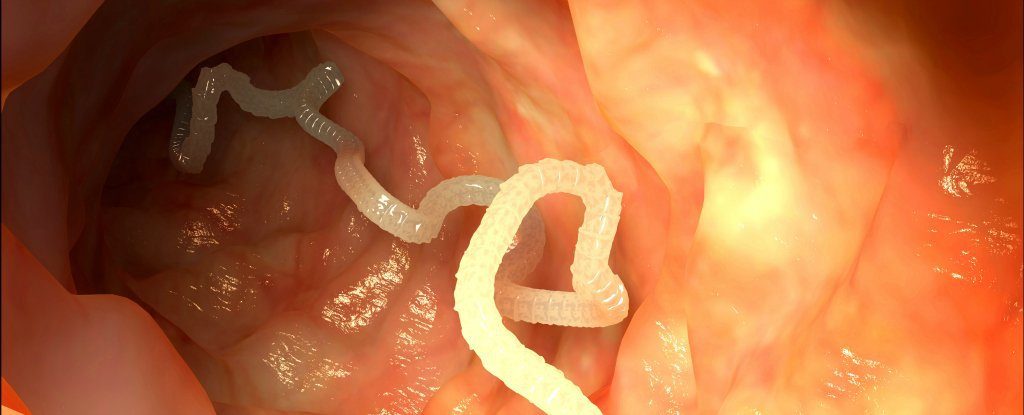Pork tapeworm