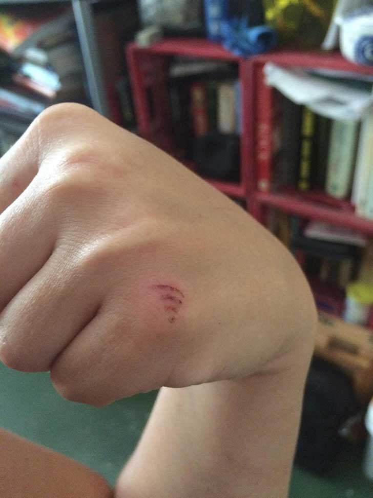 So I Cut My Hand With A Fan - And Now It Looks Like I'm Emitting Wifi.