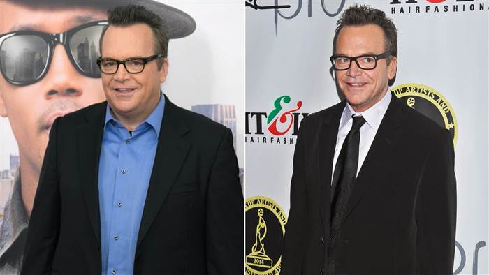 Tom Arnold - 100 Lbs. Loss