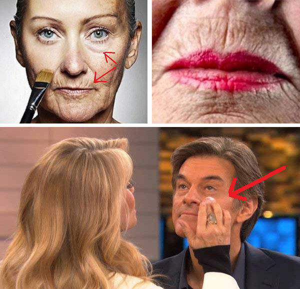 Avoid Botox: How To Remove Lip Lines and Wrinkles Quickly for FREE!