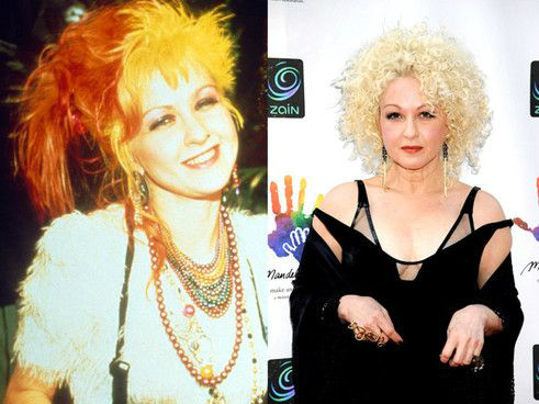 Cyndi Lauper