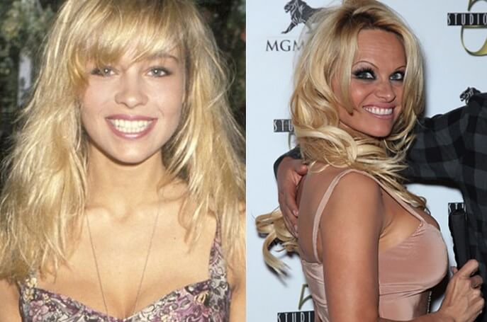 Pamela Anderson (Cashew) – 2 episodes, 1990-1991